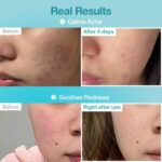 ماسک ورقه ای آبرسان و شفاف کننده B5 و هیالورونیک نامبوزین(NUMBUZIN)